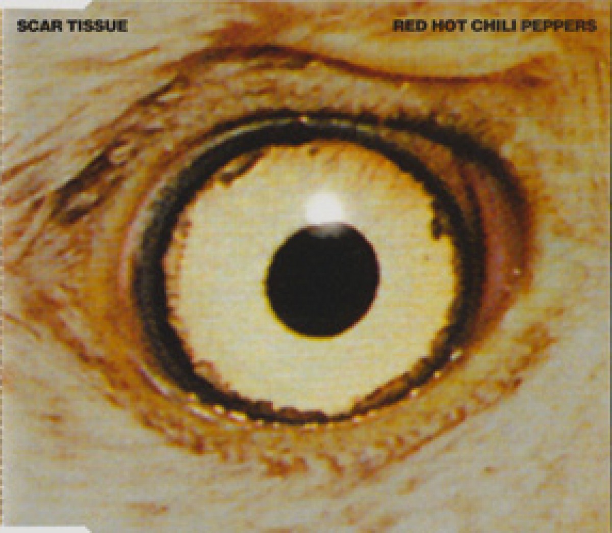 Scar Tissue