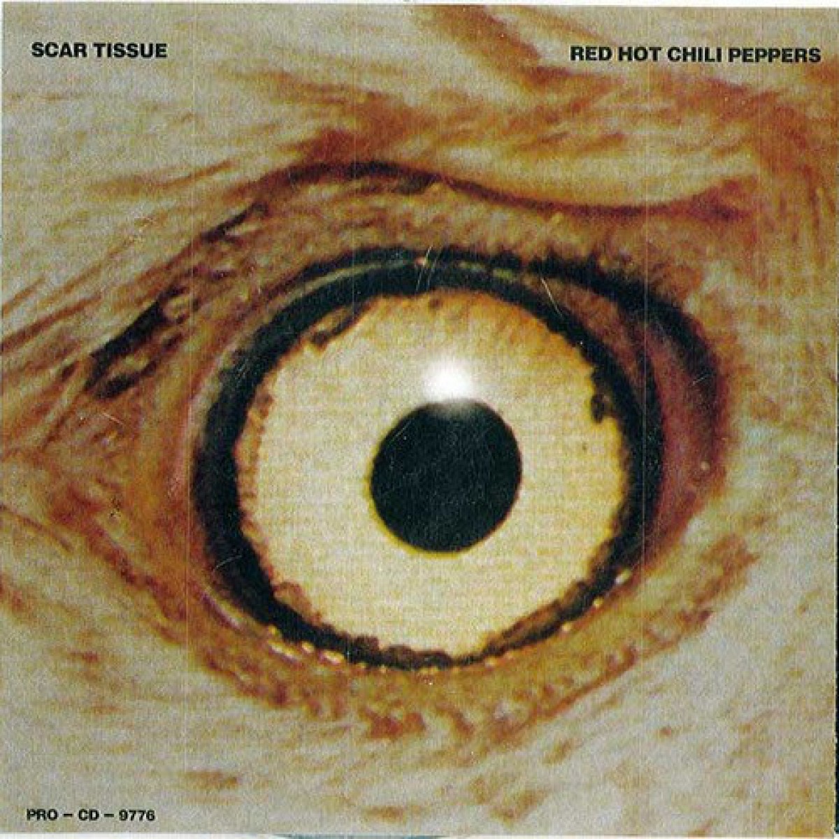 Scar Tissue